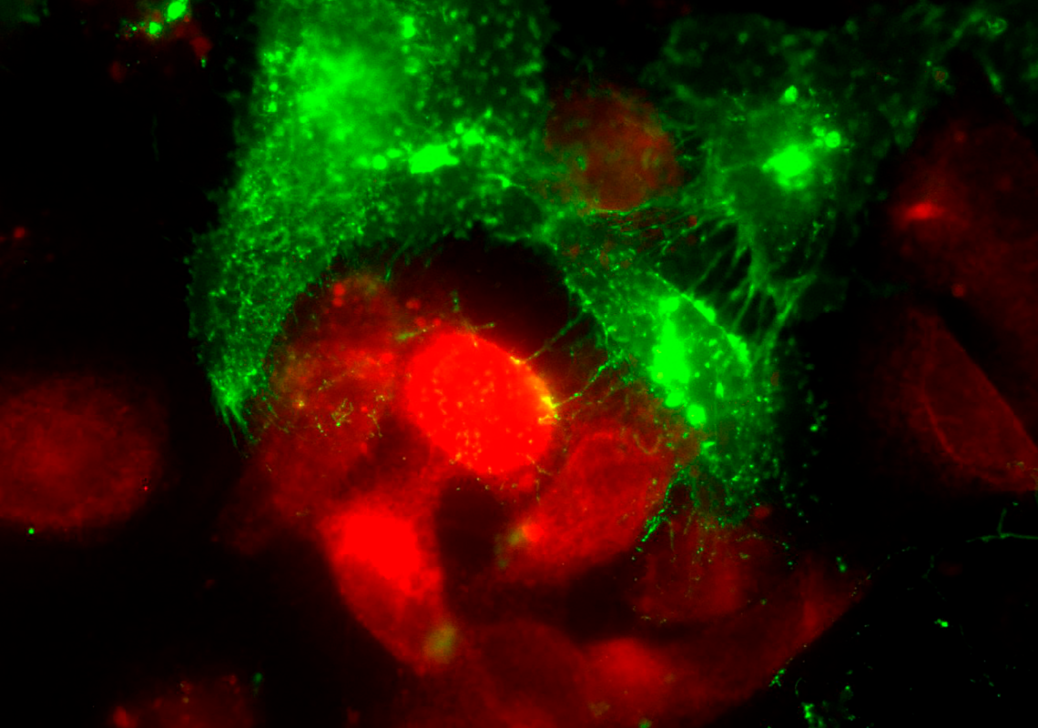 Célula tumoral modificada geneticamente, com vesículas extracelulares expressas com GFP (Green Fluorescent Protein). A Figura mostra a transferência de EVs de uma célula tumoral (MDA-MB-231, verde) para uma célula não tumoral de mama (MCF10A, vermelho). Autoria Wanessa F. Altei.