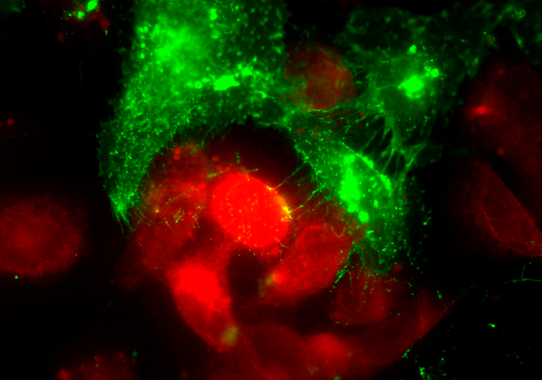 Célula tumoral modificada geneticamente, com vesículas extracelulares expressas com GFP (Green Fluorescent Protein). A Figura mostra a transferência de EVs de uma célula tumoral (MDA-MB-231, verde) para uma célula não tumoral de mama (MCF10A, vermelho). Autoria Wanessa F. Altei