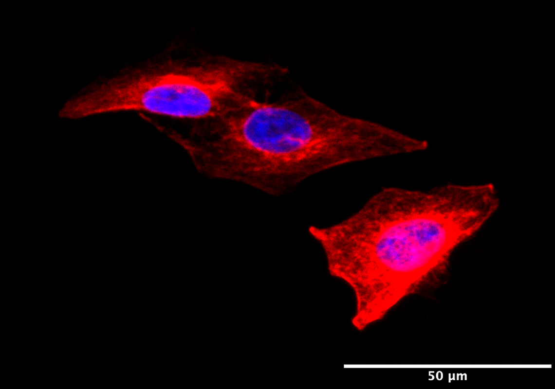 Células de tumor de mama humana (linhagem MDA-MB-231) aderidas à matriz de gelatina, em meio de cultura DMEM 10% FBS. Imagem em epifluorescência com núcleo corado com DAPI (azul) e imunomarcação dos filamentos de tubulina com AlexaFluor 647 (vermelho), adquirida no equipamento ImageXpress Micro (Molecular Devices). Aumento: 40x; Barra de escala: 50 μm. Autoria: Bianca Pachane.