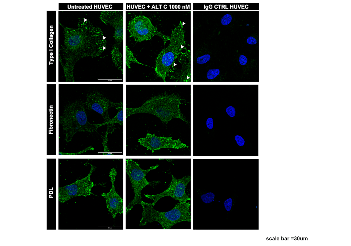 Diferentes perfis da integrina α2β1 em componentes de matriz extracelular colágeno e fibronectina por microscopia de epifluorescência. Crédito: Patty Karina dos Santos