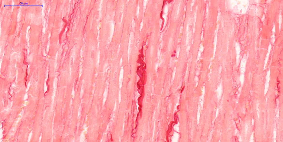 Micrografia de ventrículo esquerdo do coração de ratos Sprague Dawley, corados pela coloração Picrosirius red. Fibras colágenas evidenciadas pela cor vermelha e tecido muscular cardíaco pela coloração rosa-alaranjado. Corte: longitudinal; Aumento: 40x. Autoria: Bianca Caruso Moreira
