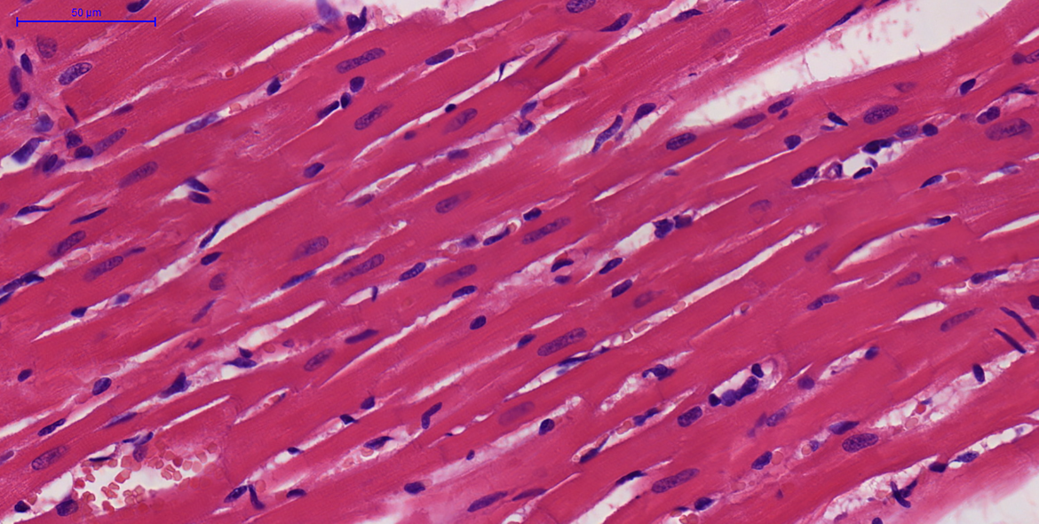 Micrografia de ventrículo esquerdo do coração de ratos Sprague Dawley, corado com Hematoxilina e Eosina (HE). Tecido muscular cardíaco evidenciado pela coloração rosa e núcleos em azul. Corte: longitudinal; Aumento: 40x; Barra de escala: 50μm. Autoria: Bianca Caruso Moreira