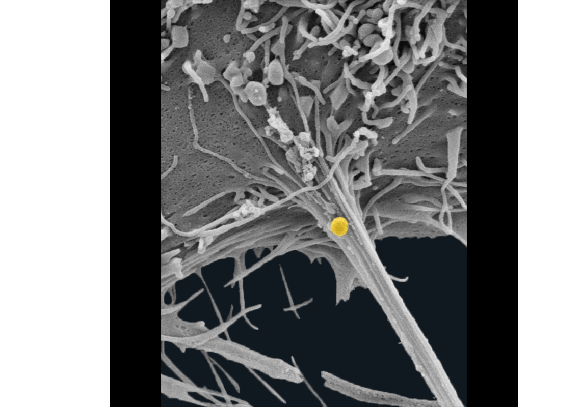 Microscopia eletrônica de varredura da célula tumoral de mama MDA-MB-231, mostrando o exato momento em que uma vesícula extracelular (EV) secretada (colorida digitalmente em amarelo), utilizando uma protrusão do citoesqueleto celular como suporte. Esta figura foi uma das vencedoras do prêmio do Concurso The Latin America Immunofluorescence & Immunohistochemistry, promovido pela empresa Abcam, em 2019. Autoria Wanessa F. Altei