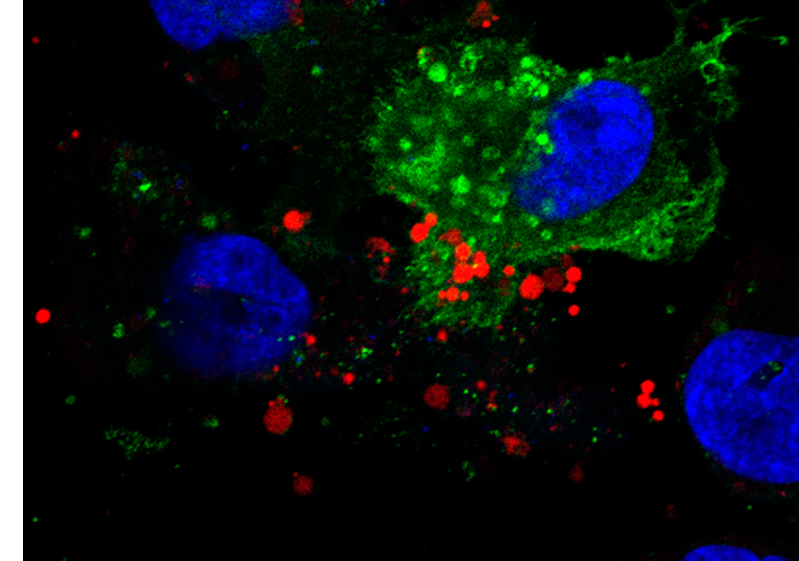 Uptake da desintegrina DisBa-01 (marcada com Alexa-fluor, vermelho), em células tumorais de mama MDA-MB-231 por microscopia confocal. Autoria: Wanessa F. Altei