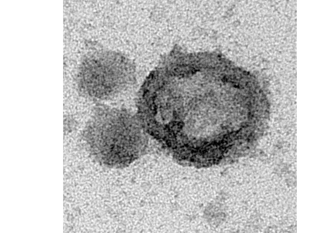 Vesículas extracelulares médias (mEV) e pequenas (sEV) isoladas de células tumorais de mama (linhagem MDA-MB-231), em microscopia eletrônica de transmissão. Barra de escala: 50 nm. Autoria: Bianca Pachane.